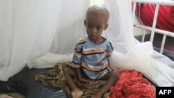 Trẻ em suy dinh dưỡng trầm trọng từ miền nam Somalia trong bệnh viện Banadir ở Mogadishu, ngày 1/8/2011